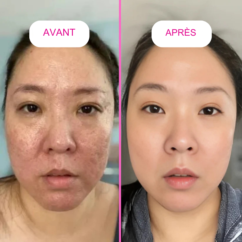 BeliaxGlow™- Masque au collagène Anti Ride - Rajeunissant pour Femme et Homme