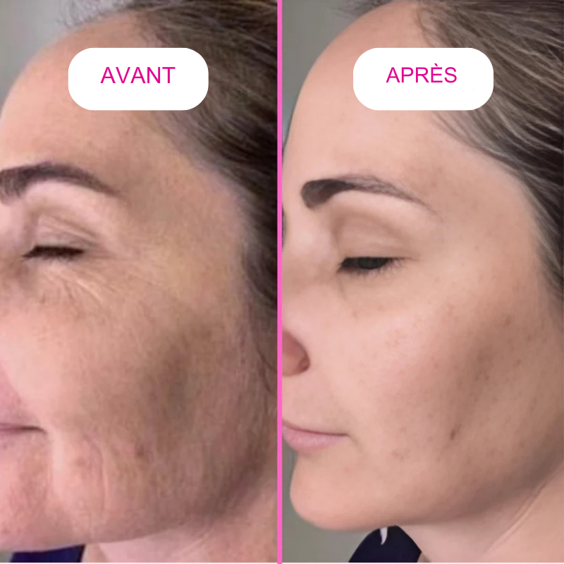 BeliaxGlow™- Masque au collagène Anti Ride - Rajeunissant pour Femme et Homme