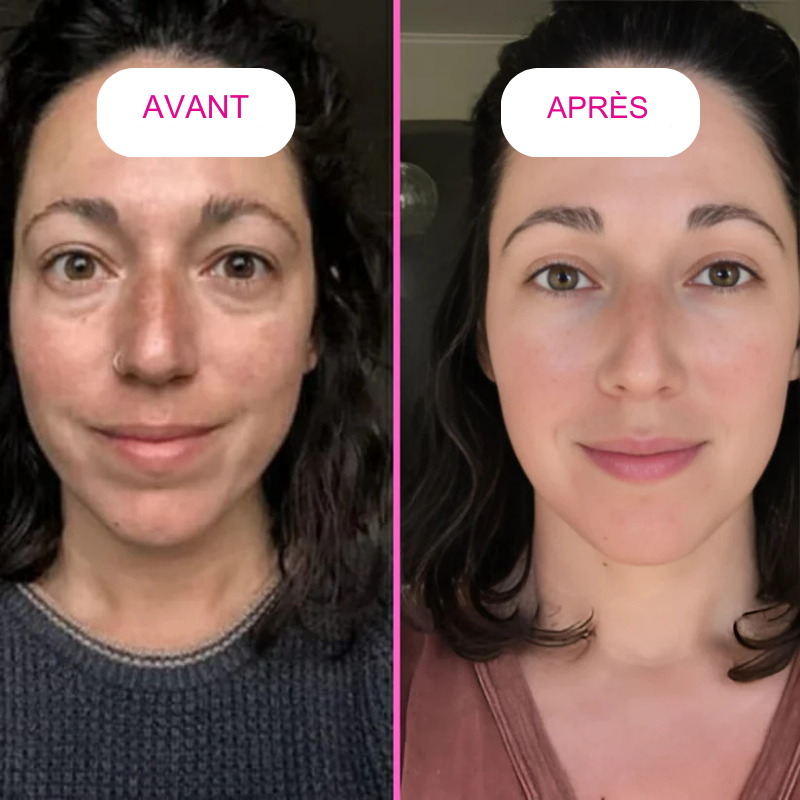 BeliaxGlow™- Masque au collagène Anti Ride - Rajeunissant pour Femme et Homme