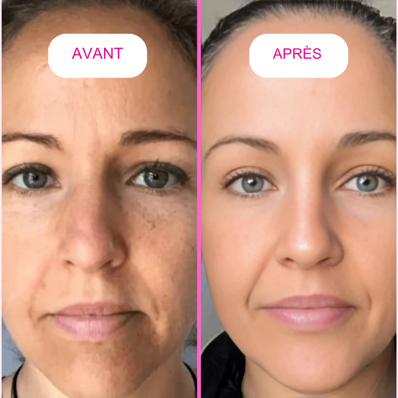 BeliaxGlow™- Masque au collagène Anti Ride - Rajeunissant pour Femme et Homme