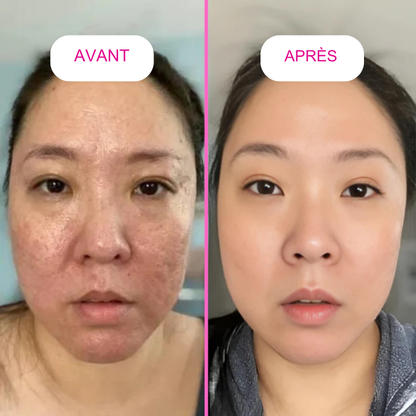 BeliaxGlow™- Anti-Wrinkle Collagen Mask - Rejuvenating for Women and Men