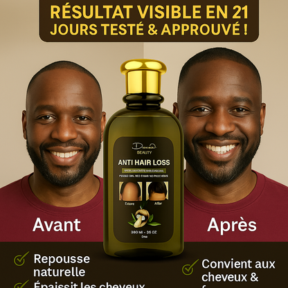 Anti-Baldness and Hair Loss Oil (6500f for the large bottle and 5500f for the small one)