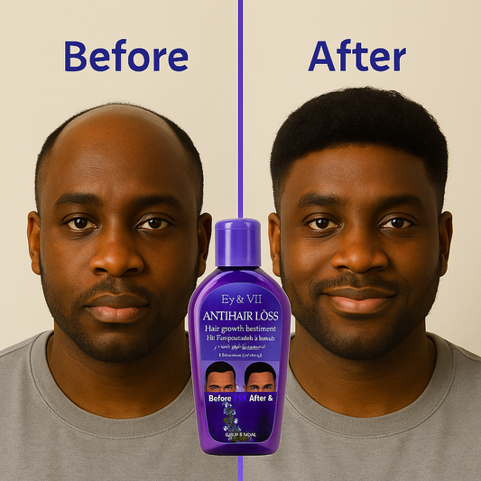 Huile Anti Calvitie et Chute de Cheveux (6500f pour la grande bouteille et 5500f pour la pétite)